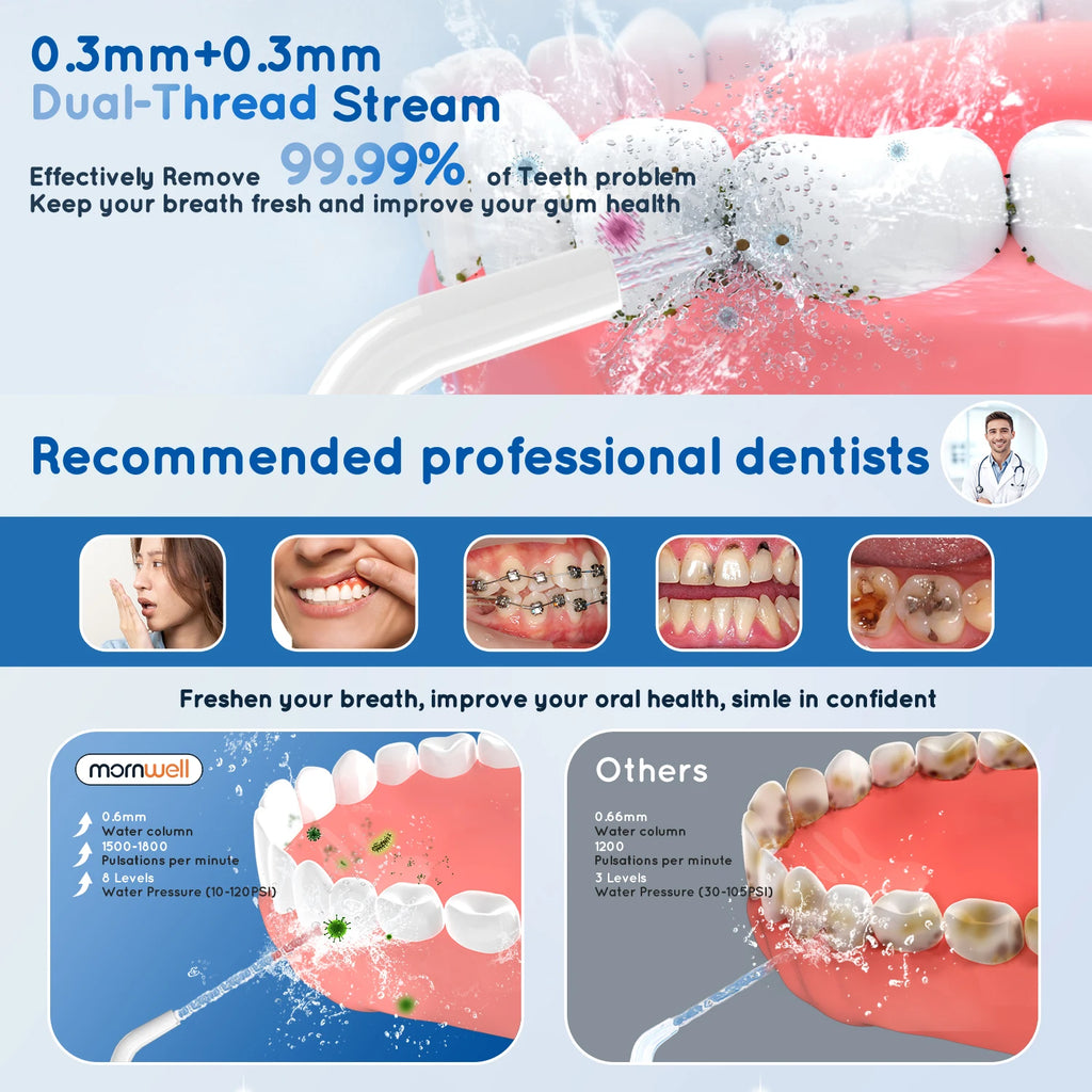 Portable Cordless Water Flosser – 3 Modes & 6 Jet Tips